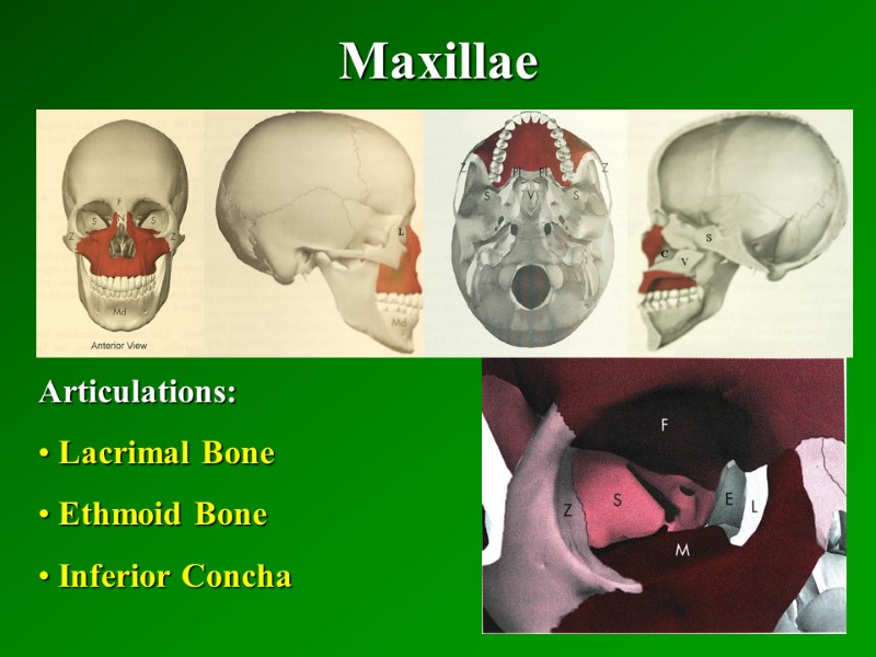 Maxillae   Articulations:  Lacrimal Bone  Ethmoid Bone  Inferior Concha